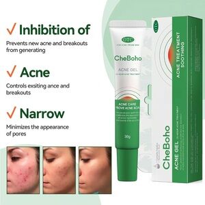 CheBoho Powerful Acne Treatment